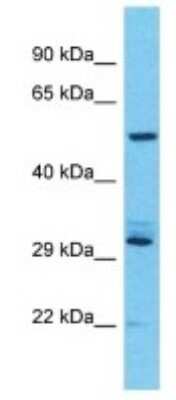 Western Blot: USP17L7 Antibody [NBP3-09905]