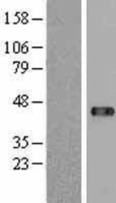 Western Blot: USP18 Overexpression Lysate [NBL1-17648]