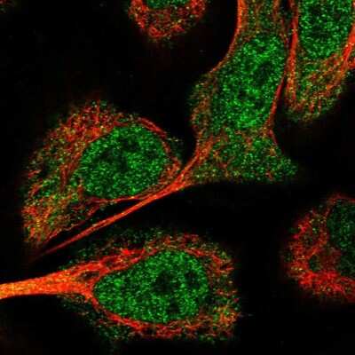 Immunocytochemistry/ Immunofluorescence: USP24 Antibody [NBP1-82942]