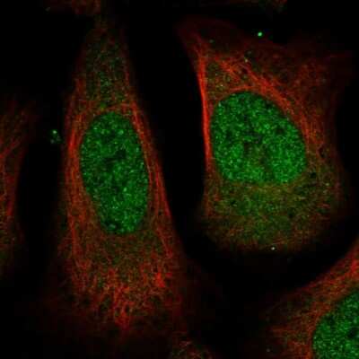 Immunocytochemistry/ Immunofluorescence: USP24 Antibody [NBP1-82943]