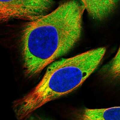 Immunocytochemistry/ Immunofluorescence: USP25 Antibody [NBP1-80630]