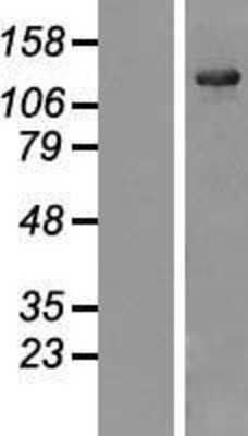 Western Blot: USP25 Overexpression Lysate [NBL1-17654]