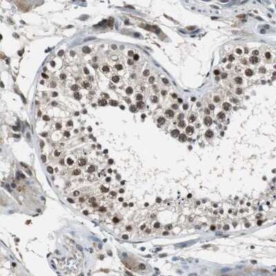 Immunohistochemistry-Paraffin: USP28 Antibody [NBP1-82904]