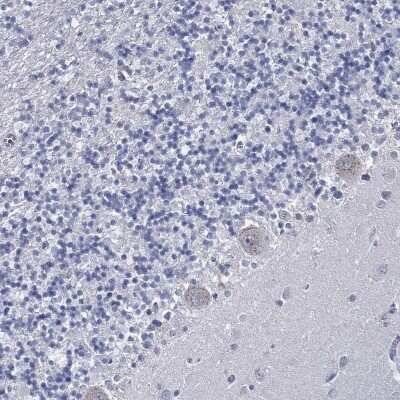 Immunohistochemistry-Paraffin: USP29 Antibody [NBP3-17070]