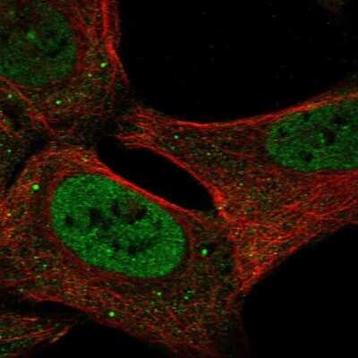 Immunocytochemistry/ Immunofluorescence: USP3 Antibody [NBP2-69056]
