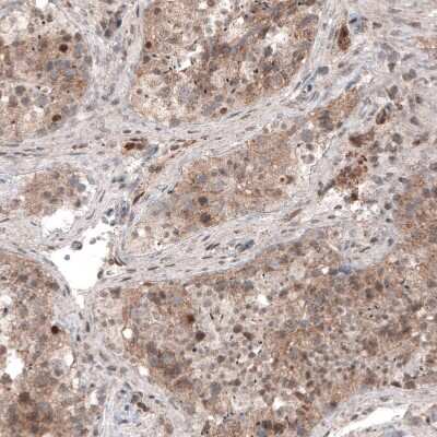 Immunohistochemistry-Paraffin: USP30 Antibody (CL4438) [NBP2-59049]