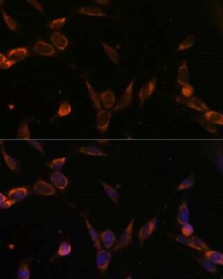 Immunocytochemistry/ Immunofluorescence: USP30 Antibody - Azide and BSA Free [NBP2-93487]