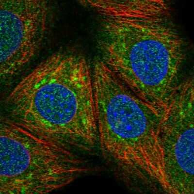 Immunocytochemistry/ Immunofluorescence: USP32 Antibody [NBP2-13509]
