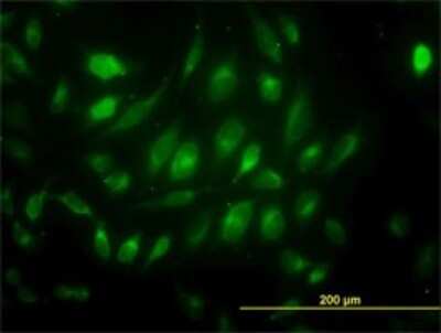 Immunocytochemistry/ Immunofluorescence: USP33 Antibody (5B5) [H00023032-M01]