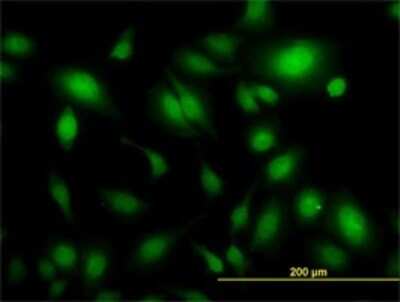 Immunocytochemistry/ Immunofluorescence: USP34 Antibody (2E2) [H00009736-M01]