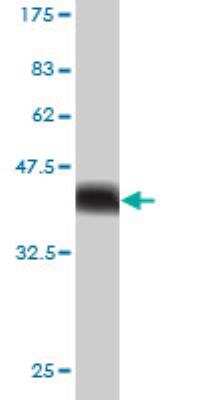 Western Blot: USP34 Antibody (2E2) [H00009736-M01]