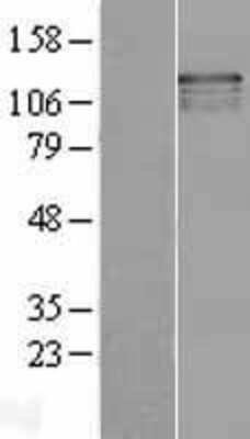 Western Blot: USP37 Overexpression Lysate [NBL1-17660]