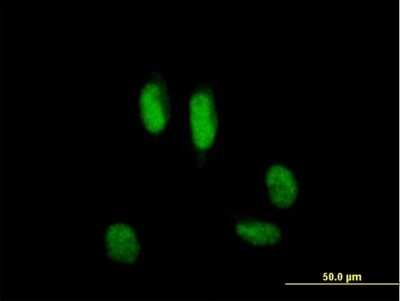 Immunocytochemistry/ Immunofluorescence: USP39 Antibody [H00010713-B01P]