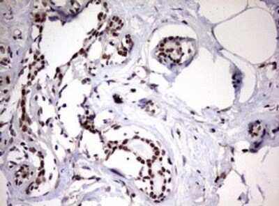 Immunohistochemistry: USP44 Antibody (OTI1D1) [NBP2-46306]