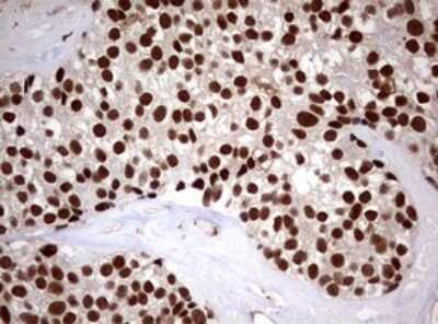 Immunohistochemistry: USP44 Antibody (OTI1D1) [NBP2-46306]
