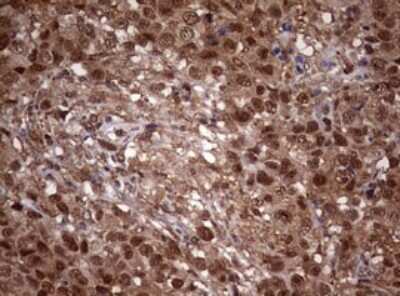 Immunohistochemistry: USP44 Antibody (OTI1D1) [NBP2-46306]