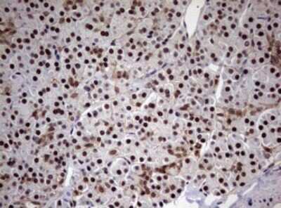 Immunohistochemistry: USP44 Antibody (OTI1D1) [NBP2-46306]