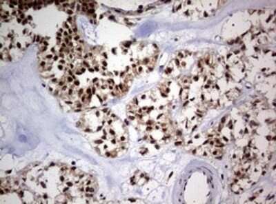 Immunohistochemistry: USP44 Antibody (OTI1D1) [NBP2-46306]