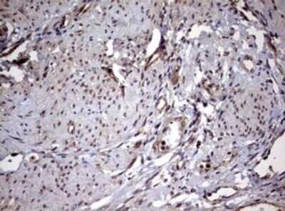 Immunohistochemistry: USP44 Antibody (OTI1D1) [NBP2-46306]