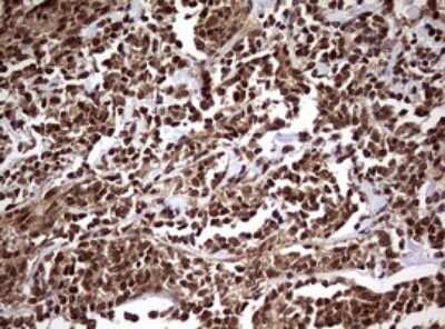 Immunohistochemistry: USP44 Antibody (OTI1D1) [NBP2-46306]