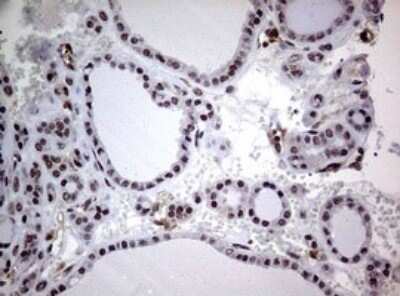 Immunohistochemistry: USP44 Antibody (OTI1D1) - Azide and BSA Free [NBP2-74811]