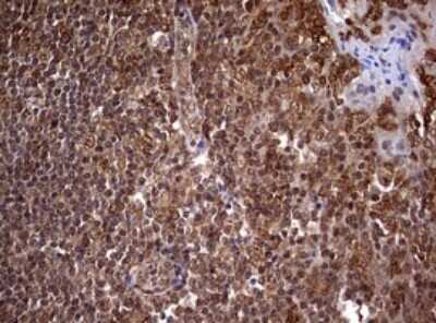 Immunohistochemistry: USP44 Antibody (OTI1D1) - Azide and BSA Free [NBP2-74811]