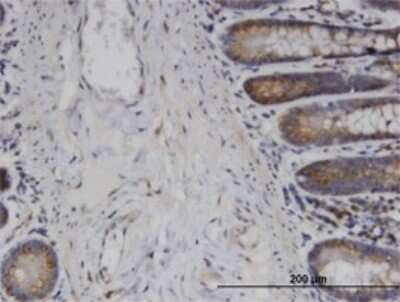Immunohistochemistry-Paraffin: USP45 Antibody (1H2) [H00085015-M01]