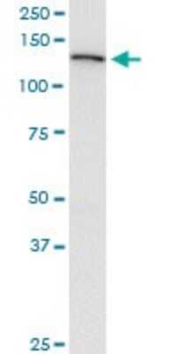 Western Blot: USP45 Antibody (1H2) [H00085015-M01]