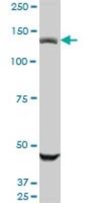 Western Blot: USP45 Antibody (1H2) [H00085015-M01]