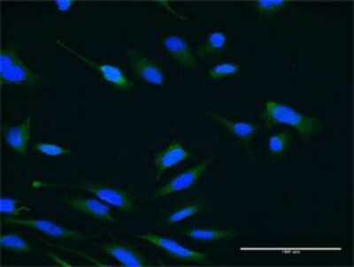 Immunocytochemistry/ Immunofluorescence: USP47 Antibody (1E6) [H00055031-M02]