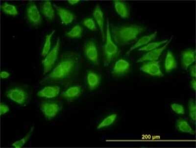 Immunocytochemistry/ Immunofluorescence: USP47 Antibody (5F9) [H00055031-M01]