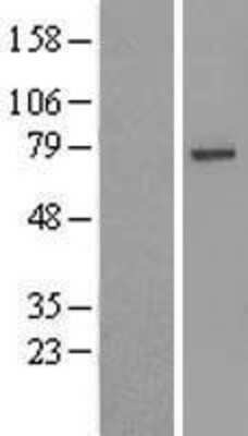 Western Blot: USP49 Overexpression Lysate [NBL1-17668]
