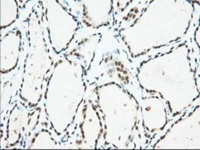 Immunohistochemistry-Paraffin: Isopeptidase T/USP5 Antibody (OTI2E3) [NBP2-02648]