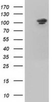 Western Blot: Isopeptidase T/USP5 Antibody (OTI2E3) [NBP2-02648]