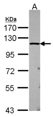 Western Blot: Isopeptidase T/USP5 Antibody [NBP2-20838]