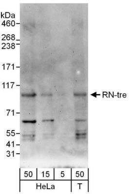 Western Blot: USP6NL Antibody [NBP1-47264]
