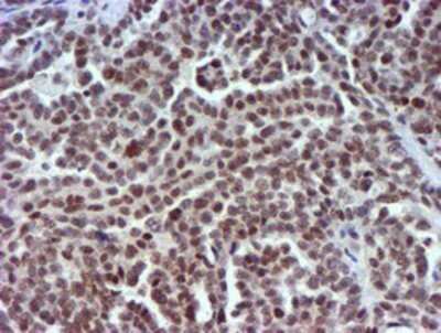 Immunohistochemistry: USP7 Antibody (OTI1F12) - Azide and BSA Free [NBP2-74814]