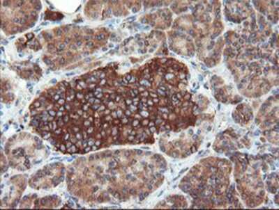 Immunohistochemistry-Paraffin: USP9x Antibody (OTI2G7) [NBP2-03824]