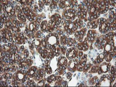Immunohistochemistry-Paraffin: USP9x Antibody (OTI2G7) [NBP2-03824]