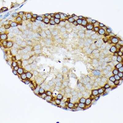 Immunohistochemistry-Paraffin: USP9x Antibody (7T0S2) [NBP3-16884]