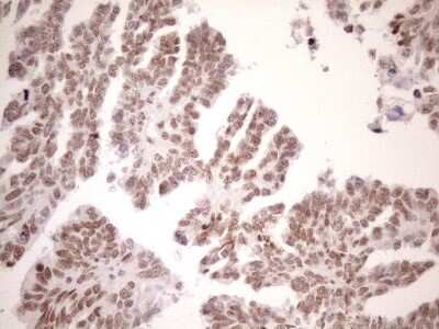 Immunohistochemistry: UTP11L Antibody (OTI5F3) [NBP2-46318]