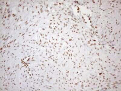 Immunohistochemistry: UTP11L Antibody (OTI5F3) [NBP2-46318]