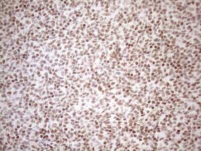 Immunohistochemistry: UTP11L Antibody (OTI5F3) [NBP2-46318]