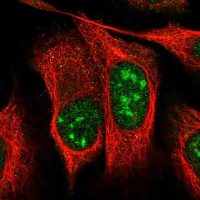 Immunocytochemistry/ Immunofluorescence: UTP11L Antibody [NBP1-92567]