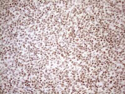 Immunohistochemistry: UTP11L Antibody (OTI5F3) - Azide and BSA Free [NBP2-74823]