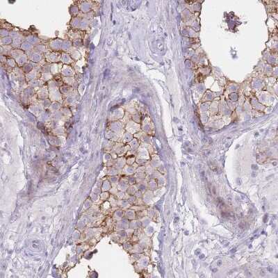 Immunohistochemistry-Paraffin: UTP14C Antibody [NBP2-33483]