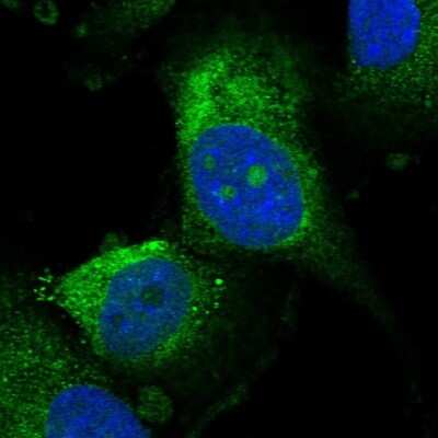 Immunocytochemistry/ Immunofluorescence: UTP15 Antibody [NBP2-58570]