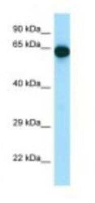 Western Blot: UTP15 Antibody [NBP1-98382]