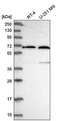 Western Blot: UTP15 Antibody [NBP2-58570]
