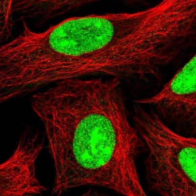 Immunocytochemistry/ Immunofluorescence: UTP18 Antibody [NBP2-13511]